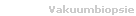 Vakuumbiopsie